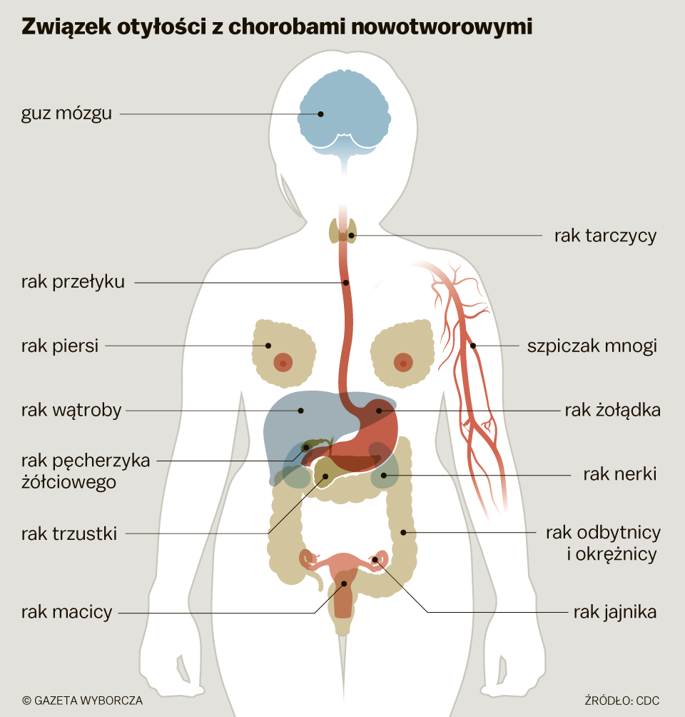 Otyłość pogarsza rokowania u chorych na COVID-19